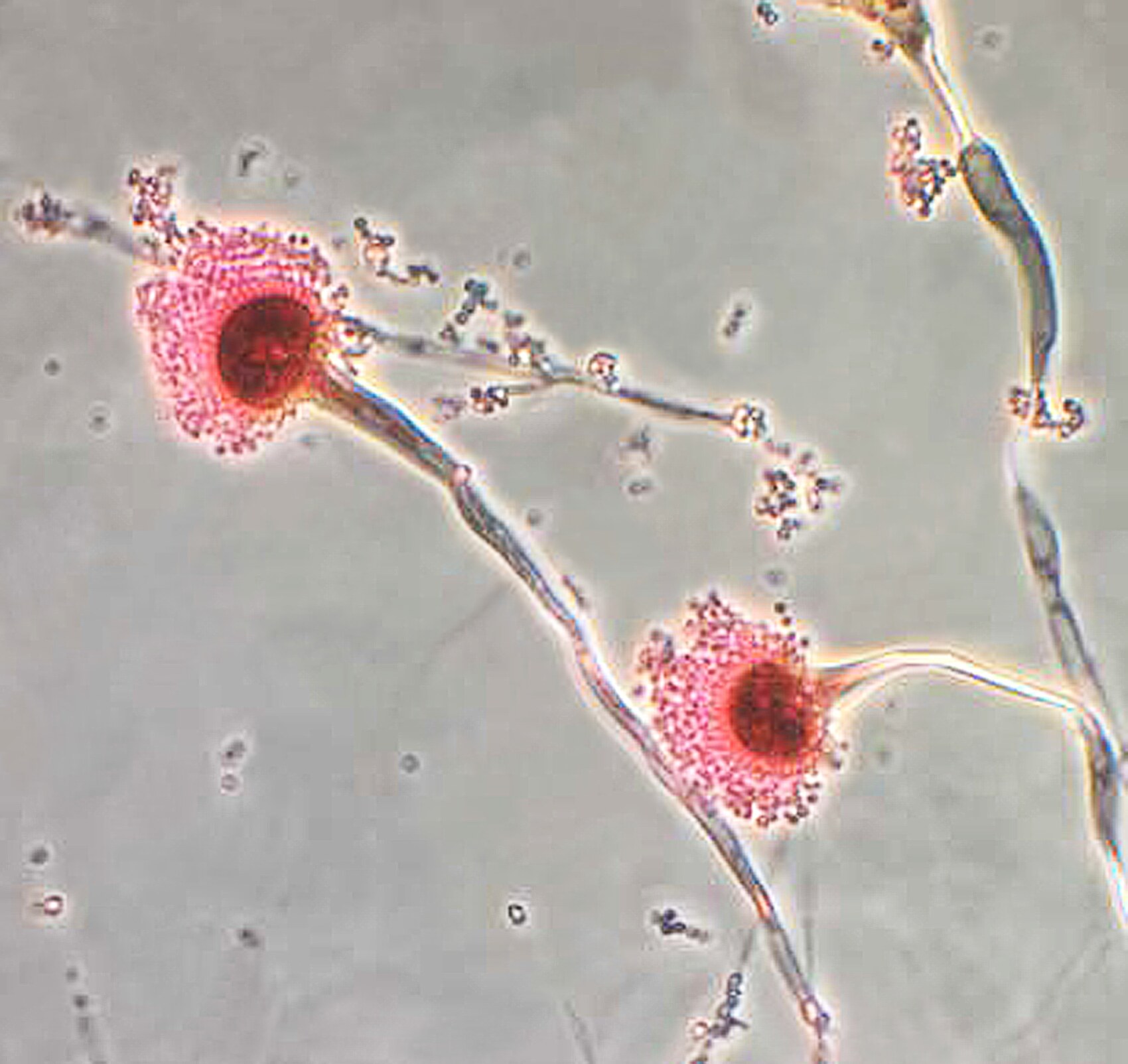 Microscopic image of Aspergillus conidial structures