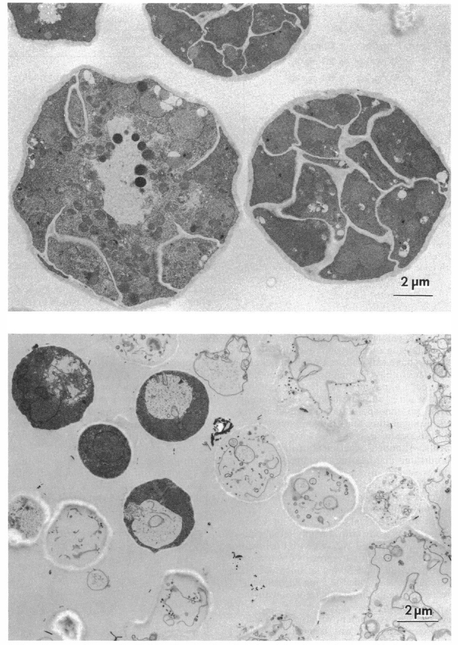 Hector et al. 1990 Figure 1 comparing untreated Coccidioides spherules with nikkomycin Z-treated spherules